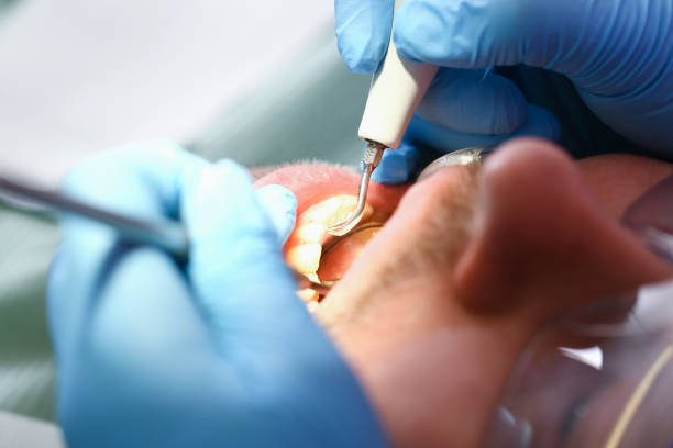 Best Urgent Dental Care for Toothache in Middletown, CA