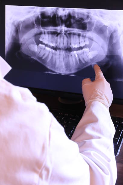 Best Emergency Dental Services for Seniors in Middletown, CA