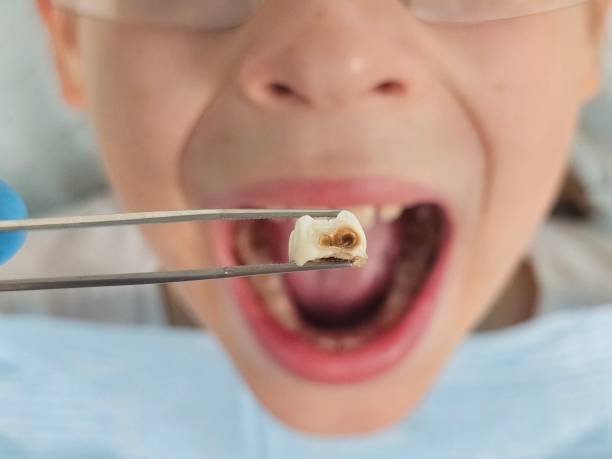 Best Weekend Emergency Dentist in Middletown, CA