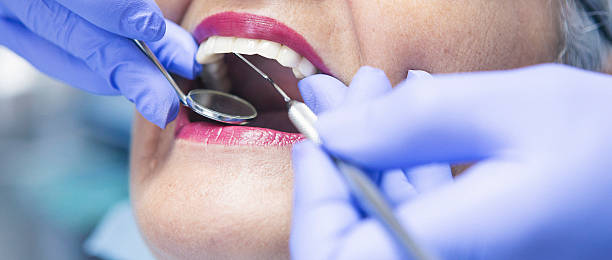 Best Emergency Dentist for Knocked-Out Tooth in Middletown, CA